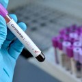 Coronavirus, 399 nuovi casi e 9 decessi in Puglia