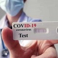 Test rapidi in farmacia per accertare la guarigione dal Covid-19